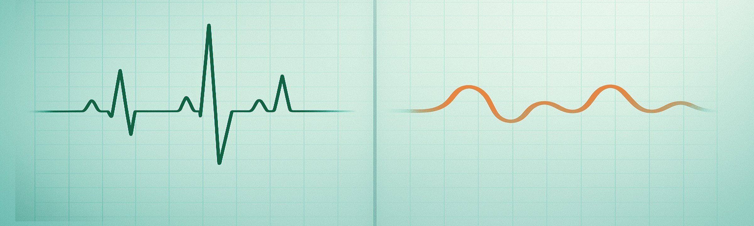 Illustration: a heartbeat (ECG) trace and a heart sound (PCG) wave side by side