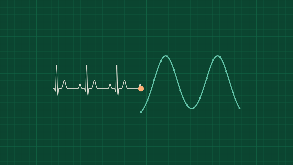 Contractions read from the heart’s own signals — Nuvo cover picture