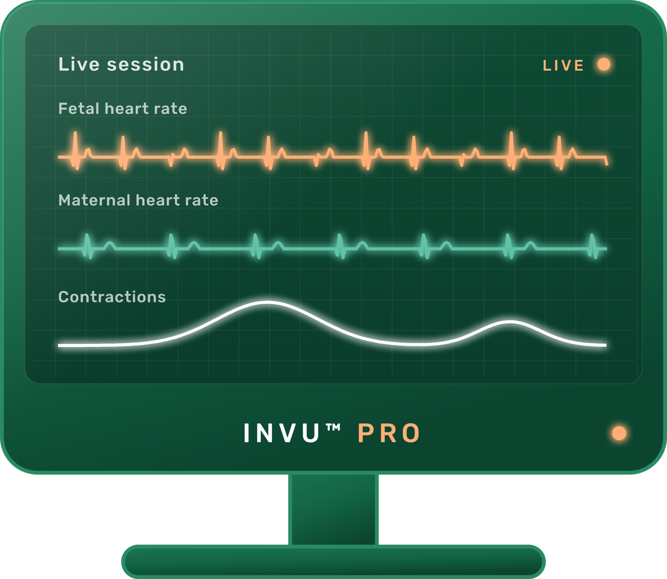 INVU Pro on the clinician's screen