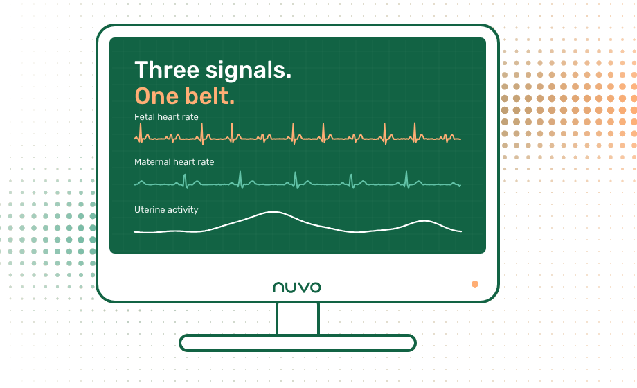 INVU Pro on a clinic monitor: fetal heart rate, maternal heart rate and uterine activity