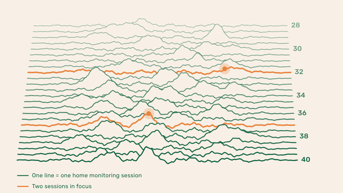 Illustrative ridgeline: each line is one home monitoring session from week 28 to week 40 of pregnancy, two sessions highlighted in peach