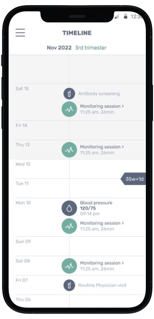 Mobile-timeline Mobile-timeline
